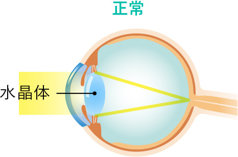 正常な目のイラスト
